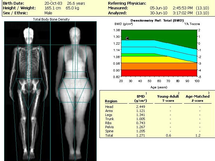 DXA Scan Anandorthopedic